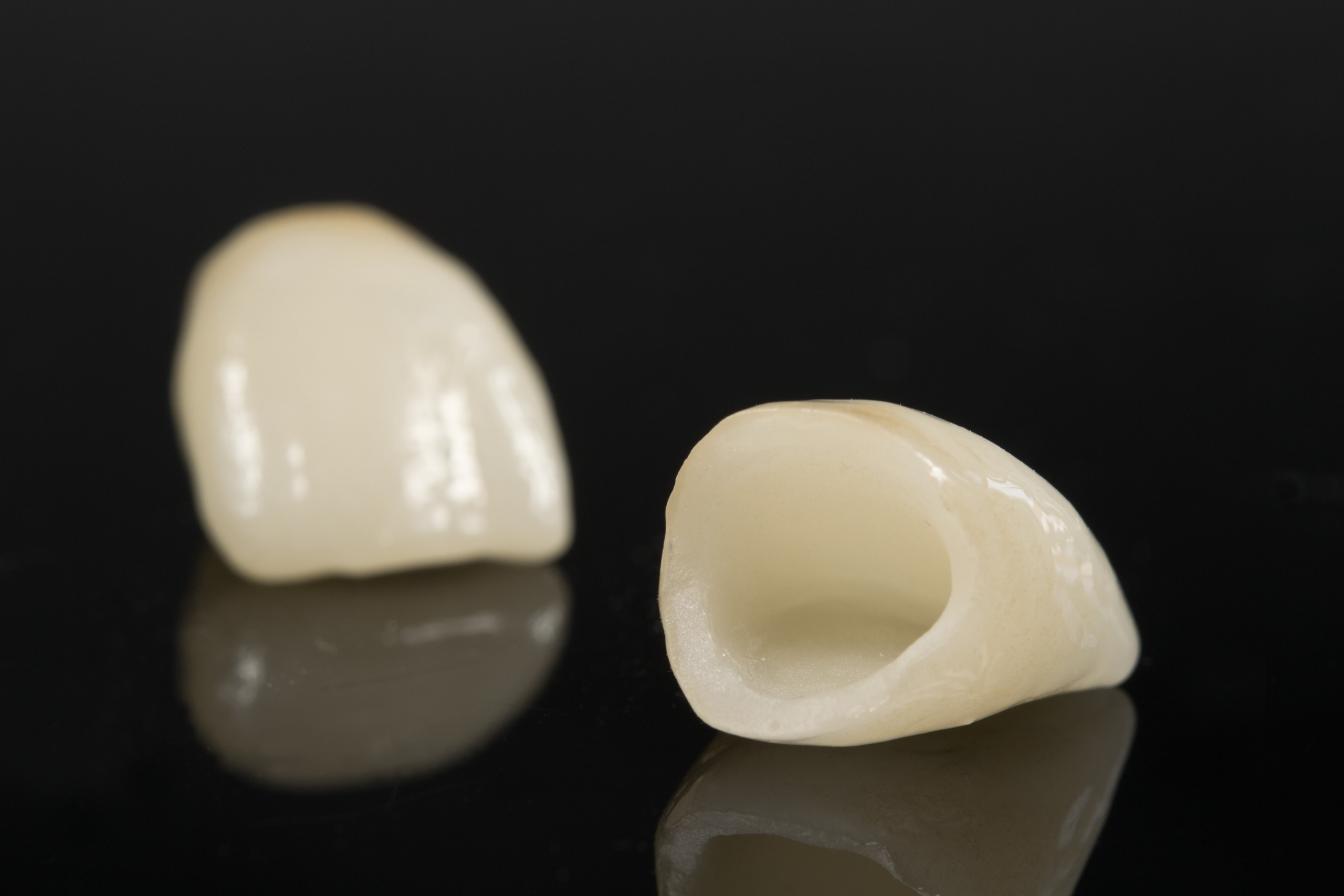 Coroas de dentes de impressão 3D