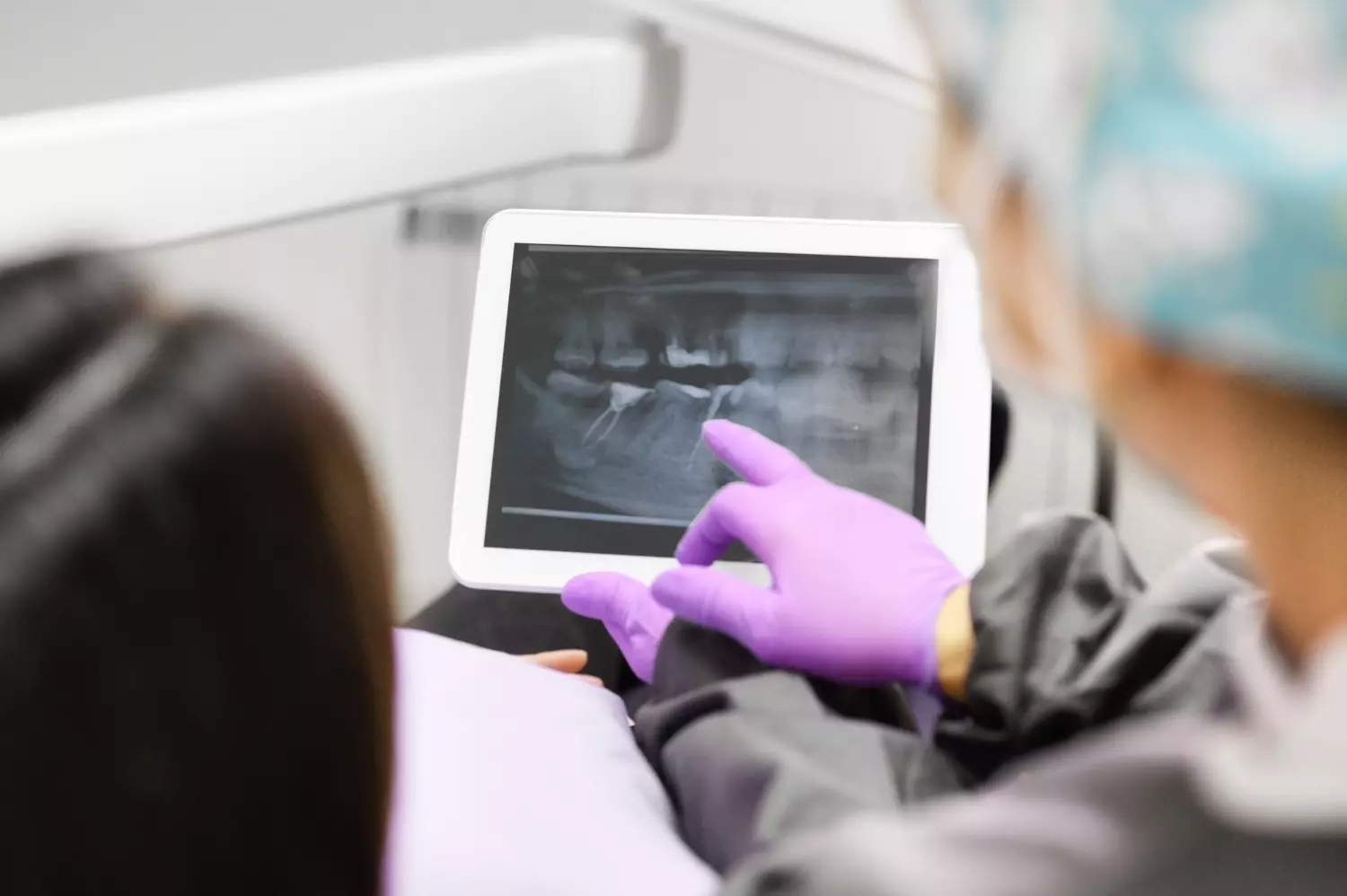 Benefícios do Scanner Intraoral 