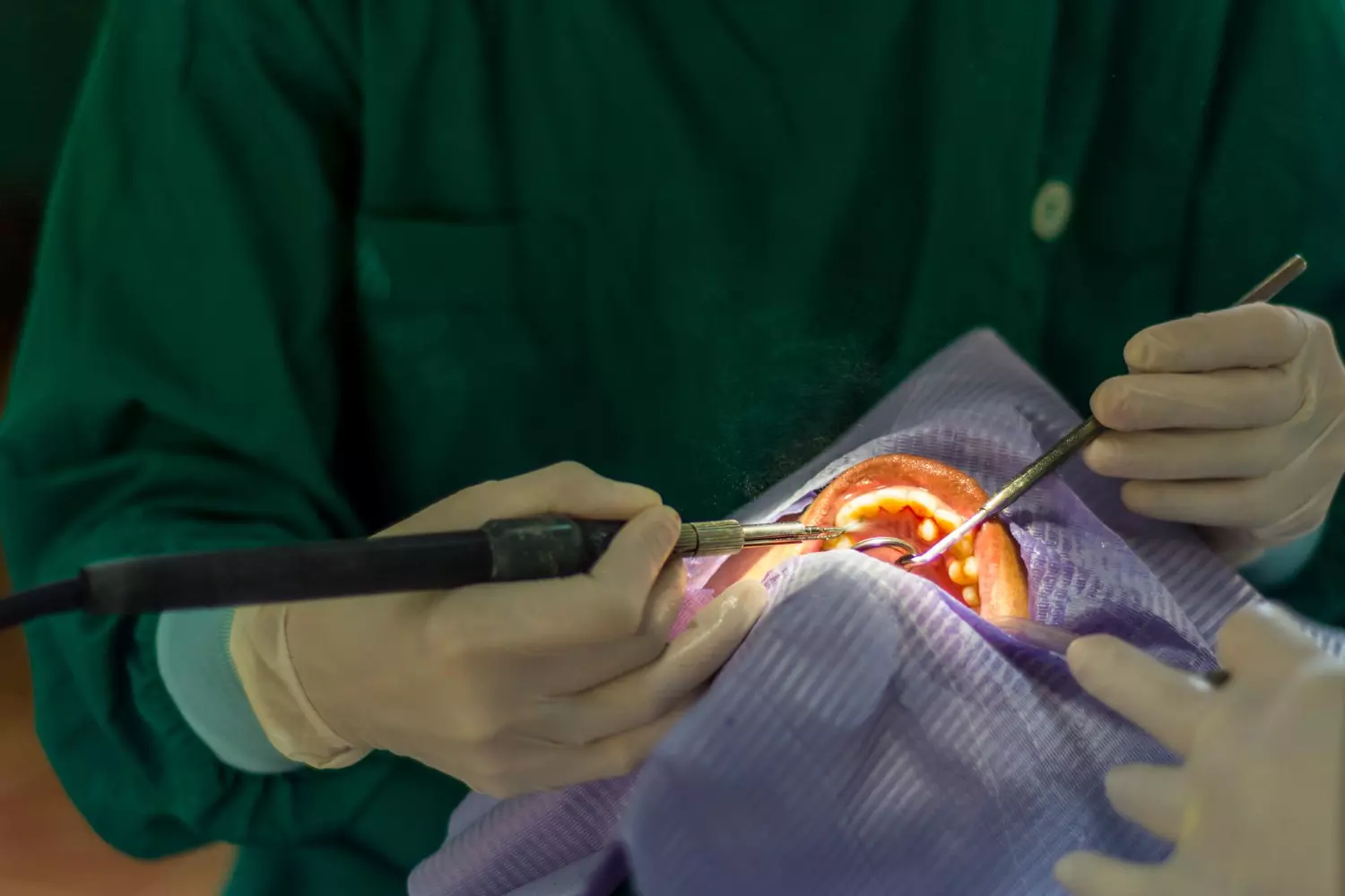 Cirurgia ortognática
